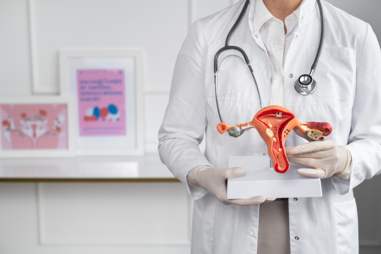 From PCOS to Endometriosis: Ayurvedic Know-How to the Rescue