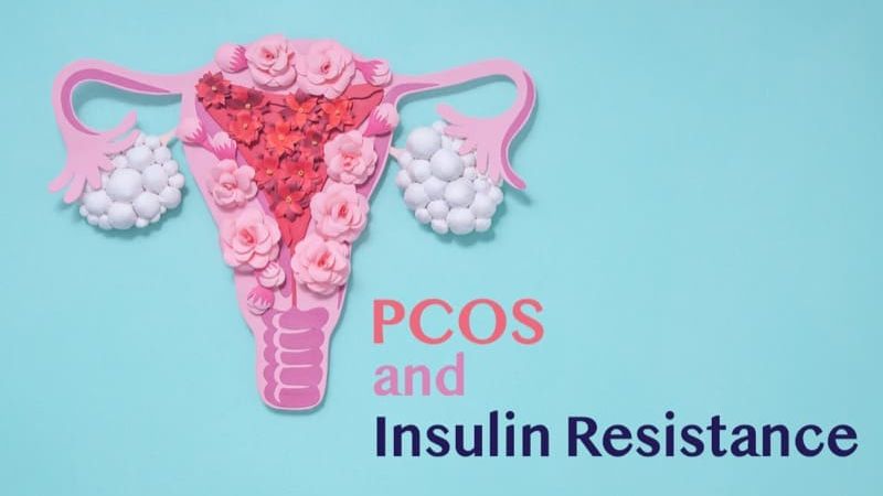 Unmasking Metabolic PCOS and Insulin Resistance